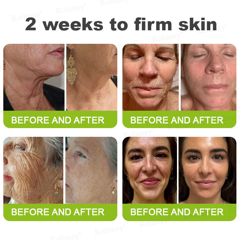 💫💯Made and shipped from the UK 💫Rolimey® Botox & Vita-A Retinol Shot Wrinkle-Lift Tightening cream - Last Day Promotion 50% OFF