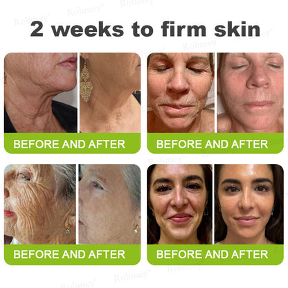 💫💯Made and shipped from the UK 💫Rolimey® Botox & Vita-A Retinol Shot Wrinkle-Lift Tightening cream - Last Day Promotion 50% OFF