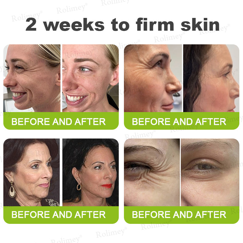 💫💯Made and shipped from the UK 💫Rolimey® Botox & Vita-A Retinol Shot Wrinkle-Lift Tightening cream - Last Day Promotion 50% OFF