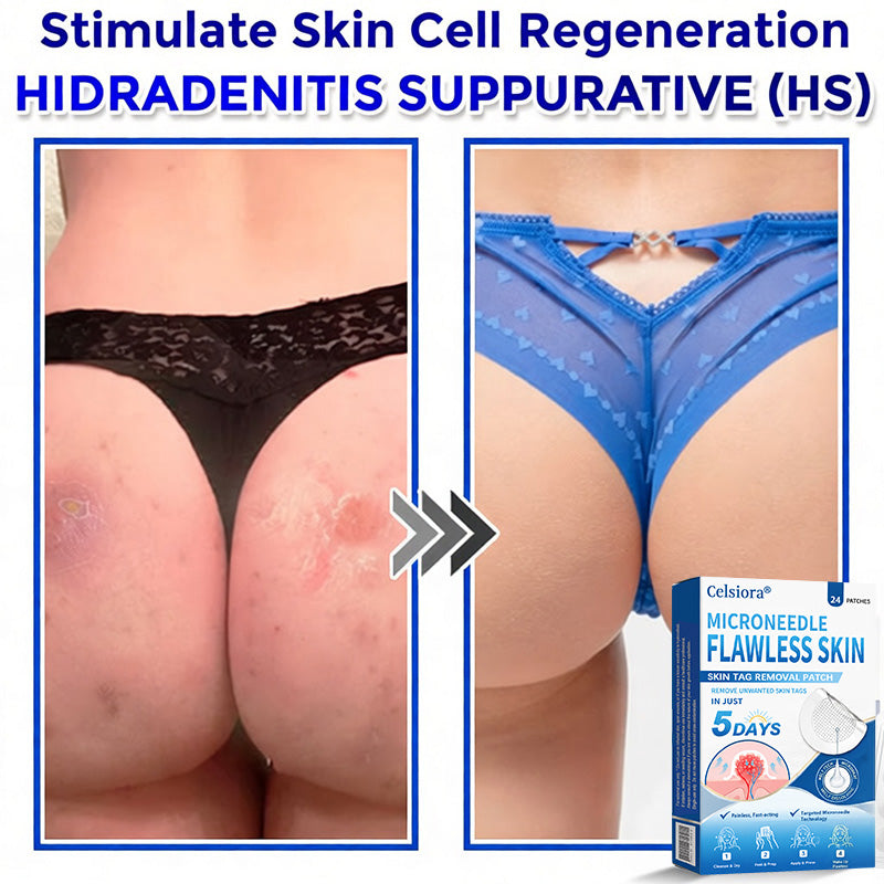 👑☘️Celsiora® 2-in-1 Microneedle & Hydrocolloid Patch | Raised Moles,Acne, Flat Warts & Skin Tags Remover | Improves Wrinkles, Scars & Blemishes | Invisible Pimple Patches for Face & Body | 24 Count