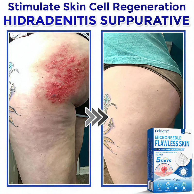 👑☘️Celsiora® 2-in-1 Microneedle & Hydrocolloid Patch | Raised Moles,Acne, Flat Warts & Skin Tags Remover | Improves Wrinkles, Scars & Blemishes | Invisible Pimple Patches for Face & Body | 24 Count