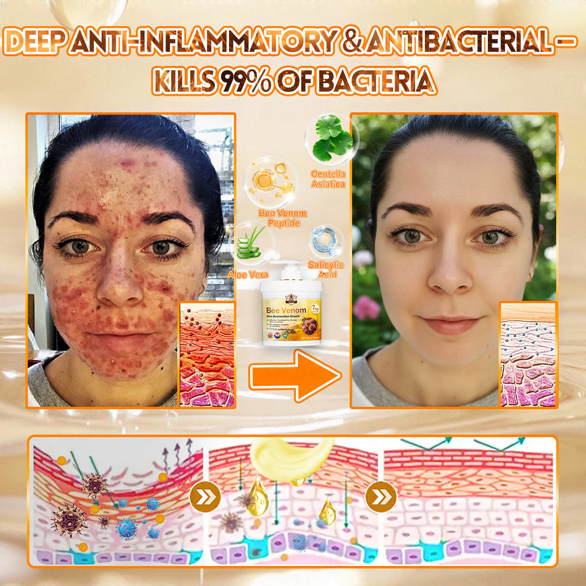 🌿👨‍⚕️Rolimey® Bee Venom Skin Restoration Cream（Anti-aging, Hydrating, Skin Repair, Even Tone, Acne and Dark Spot Treatment, Wart and Mole Removal, Psoriasis Relief)