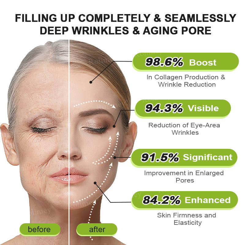 💫💯Made and shipped from the UK 💫Rolimey® Botox & Vita-A Retinol Shot Wrinkle-Lift Tightening cream - Last Day Promotion 50% OFF