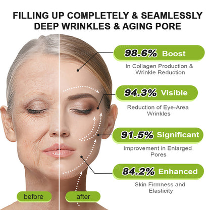 💫💯Made and shipped from the UK 💫Rolimey® Botox & Vita-A Retinol Shot Wrinkle-Lift Tightening cream - Last Day Promotion 50% OFF