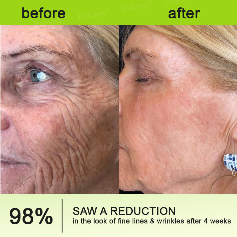 💫💯Made and shipped from the UK 💫Rolimey® Botox & Vita-A Retinol Shot Wrinkle-Lift Tightening cream - Last Day Promotion 50% OFF