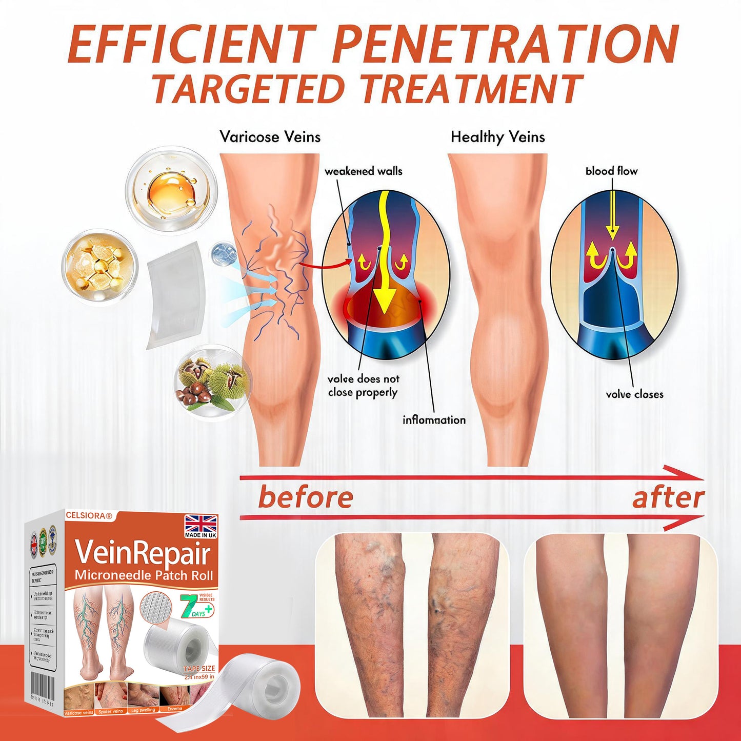🌿🤩Celsiora® Vein Ease Microneedle Care Patch(For Spider Veins, Varicose Veins, Swelling & Leg Fatigue) - Last Day Promotion 50% OFF
