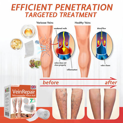 🌿🤩Celsiora® Vein Ease Microneedle Care Patch(For Spider Veins, Varicose Veins, Swelling & Leg Fatigue) - Last Day Promotion 50% OFF
