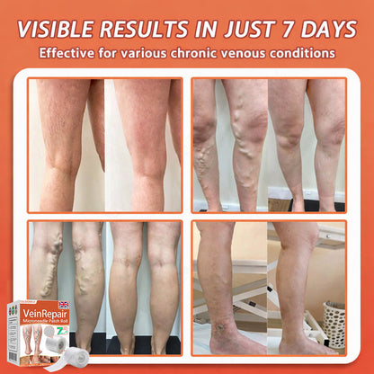 🌿🤩Celsiora® Vein Ease Microneedle Care Patch(For Spider Veins, Varicose Veins, Swelling & Leg Fatigue) - Last Day Promotion 50% OFF