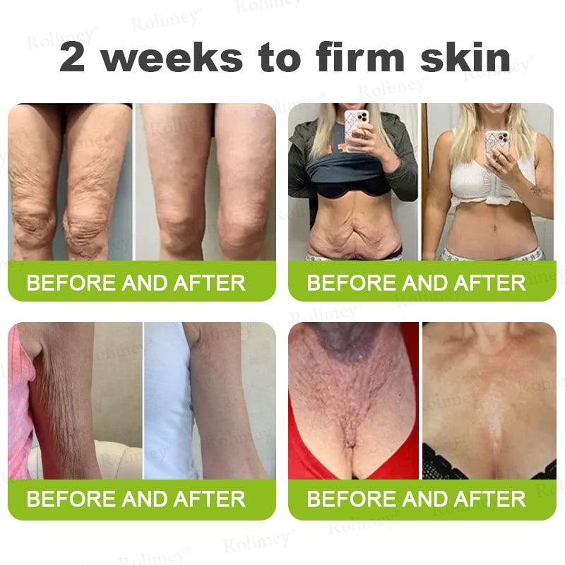 💫💯Made and shipped from the UK 💫Rolimey® Botox & Vita-A Retinol Shot Wrinkle-Lift Tightening cream - Last Day Promotion 50% OFF