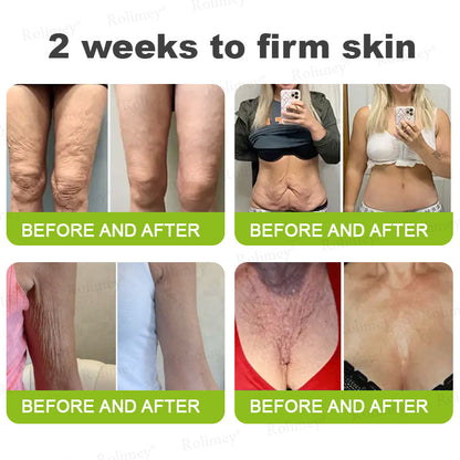 💫💯Made and shipped from the UK 💫Rolimey® Botox & Vita-A Retinol Shot Wrinkle-Lift Tightening cream - Last Day Promotion 50% OFF