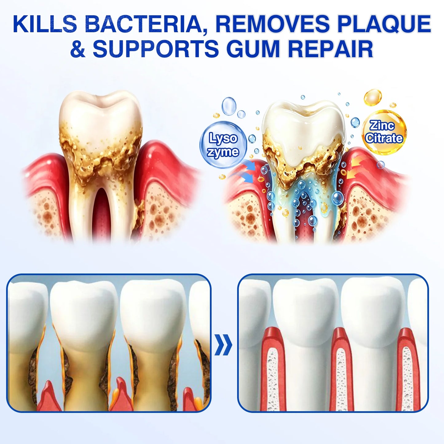 🇬🇧👨‍⚕️🦷🛡️Evolvion® GumRevive Periodontal Repair Gel