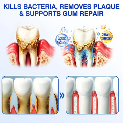 🇬🇧👨‍⚕️🦷🛡️Evolvion® GumRevive Periodontal Repair Gel