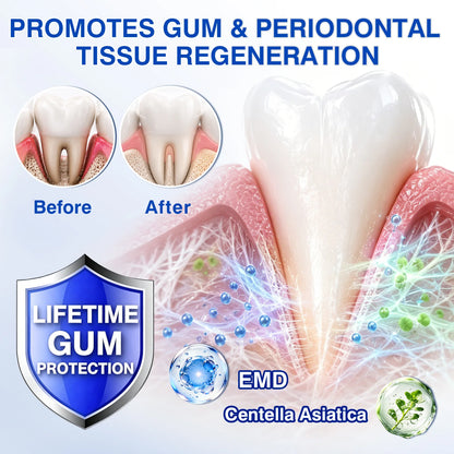 🇬🇧👨‍⚕️🦷🛡️Evolvion® GumRevive Periodontal Repair Gel