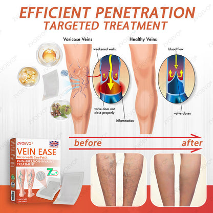 😍🎁Zvoevo® Vein Ease Microneedle Care Patch(For Spider Veins, Varicose Veins, Swelling & Leg Fatigue)