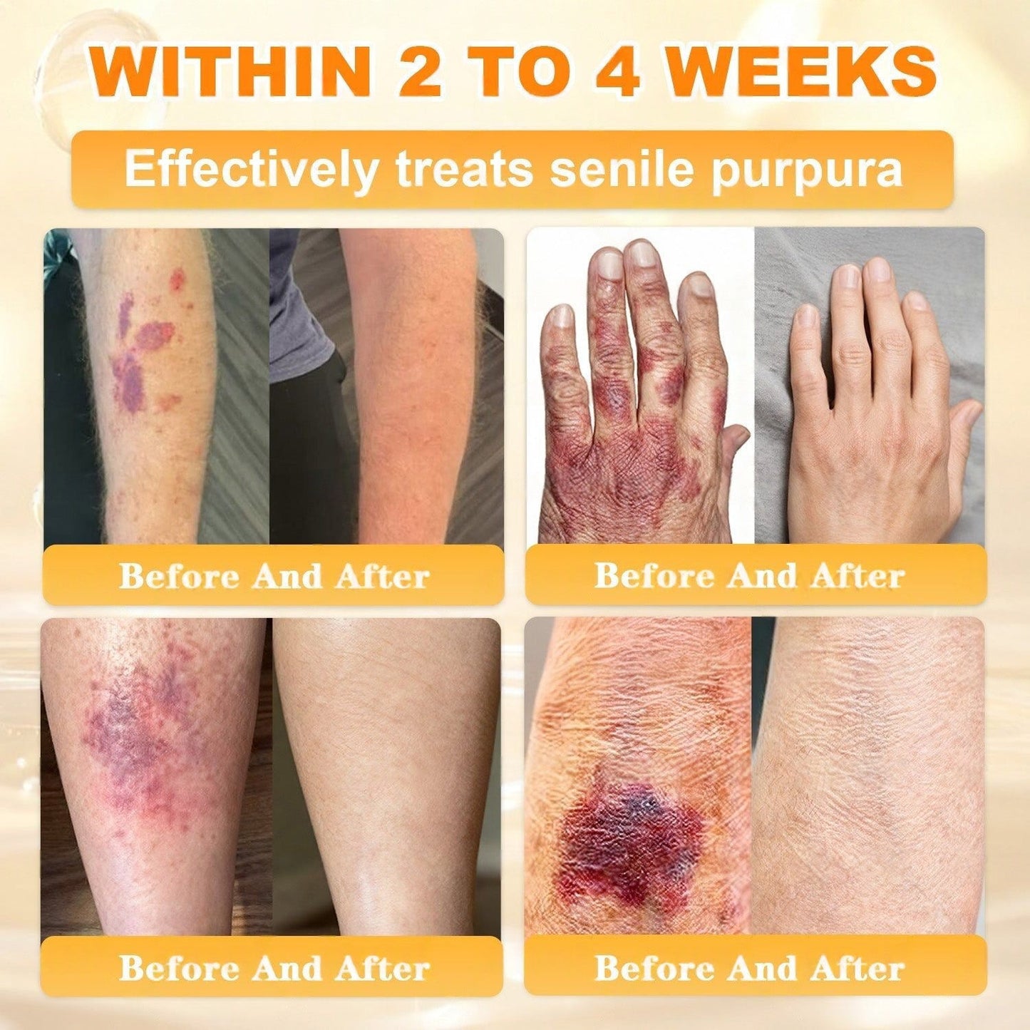 🌿👨‍⚕️Rolimey® Bee Venom Skin Restoration Cream（Anti-aging, Hydrating, Skin Repair, Even Tone, Acne and Dark Spot Treatment, Wart and Mole Removal, Psoriasis Relief)