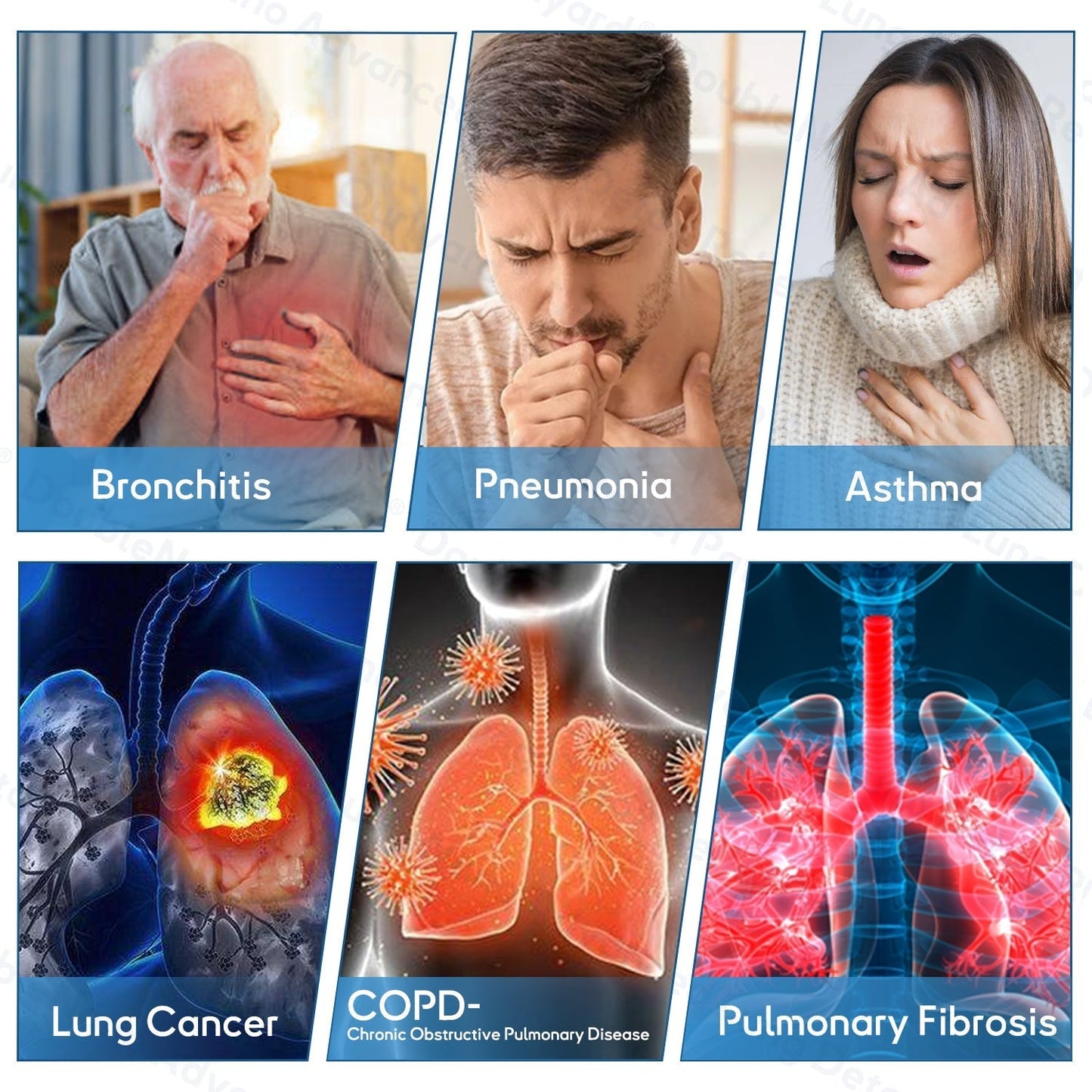 🌿🌟MHRA Approved|Zvoevo® DoubleNano COPD Relief Patch (💝 Cough, wheezing, shortness of breath, sputum, stuffy nose, bronchitis, bronchitis, allergy symptoms, lung discomfort🫁)
