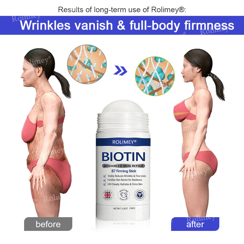 🤩Rolimey® Biotin(B7) Firming Stick – Targets Aging, Sagging & Fine Lines | Final Day: Save 50%
