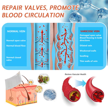 😍🎁Zvoevo® Vein Ease Microneedle Care Patch(For Spider Veins, Varicose Veins, Swelling & Leg Fatigue)