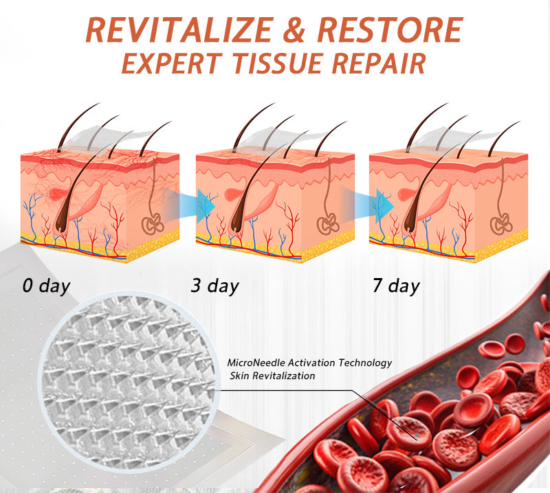 😍🎁Zvoevo® Vein Ease Microneedle Care Patch(For Spider Veins, Varicose Veins, Swelling & Leg Fatigue)