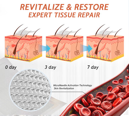 😍🎁Zvoevo® Vein Ease Microneedle Care Patch(For Spider Veins, Varicose Veins, Swelling & Leg Fatigue)