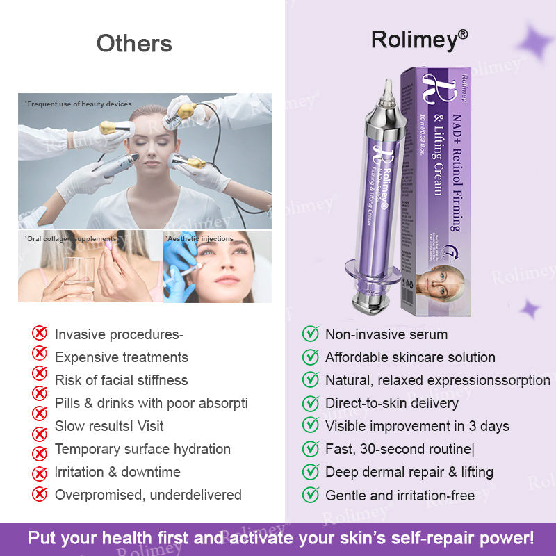 🌿🎉Rolimey® NAD+ Retinol Firming & Lifting Cream(30ml) – For Eye Bags, Dark Circles & Fine Lines | Last Day Sale: 60% OFF
