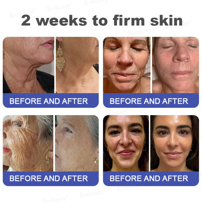 🤩Rolimey® Biotin(B7) Firming Stick – Targets Aging, Sagging & Fine Lines | Final Day: Save 50%
