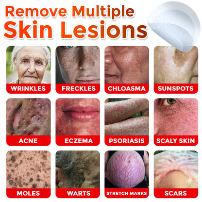 👩‍⚕️👩‍⚕️ GFOUK® MicroNeedle Botanic Skin Tag Removal Patch 🇬🇧 Made in the UK(For the removal of soft fibromas/skin tags, warts, and acne pimples)
