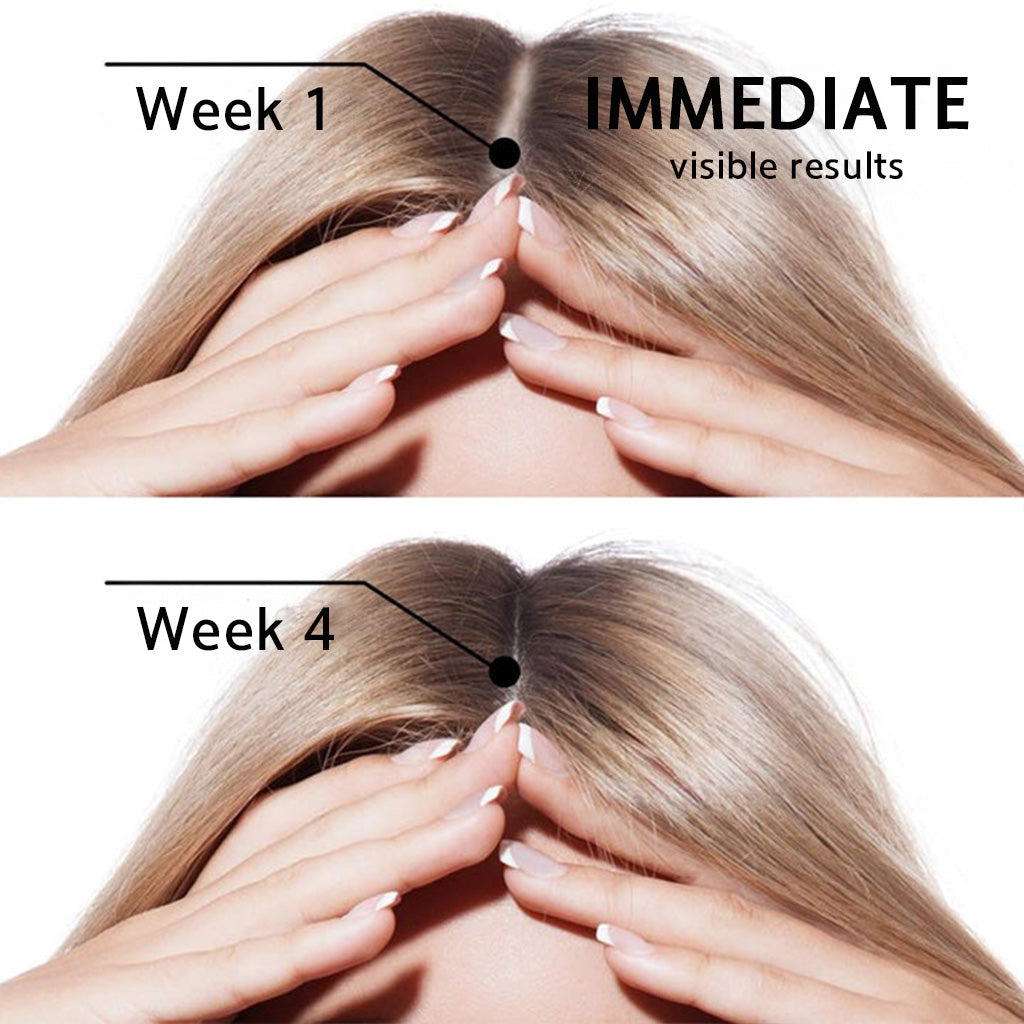 👨‍⚕️💟 Official UK Store 🇬🇧 | 🔥Rolimey® Highly Effective Biotin & Rosemary Hair Growth Serum — (🔥 Limited-Time Offer, ⏳ Last Day Promotion 50% OFF)