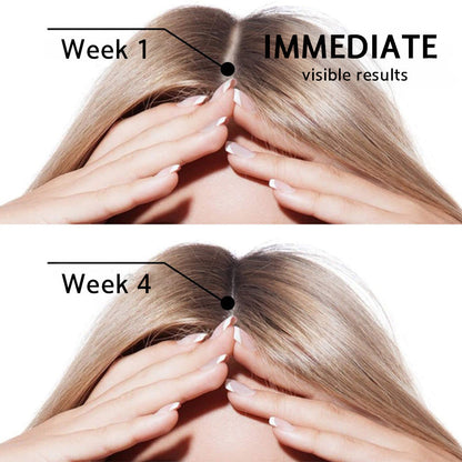 👨‍⚕️💟 Official UK Store 🇬🇧 | 🔥Rolimey® Highly Effective Biotin & Rosemary Hair Growth Serum — (🔥 Limited-Time Offer, ⏳ Last Day Promotion 50% OFF)