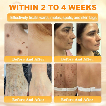 🌿👨‍⚕️Rolimey® Bee Venom Skin Restoration Cream（Anti-aging, Hydrating, Skin Repair, Even Tone, Acne and Dark Spot Treatment, Wart and Mole Removal, Psoriasis Relief)