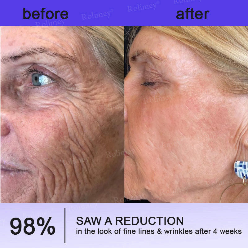 🤩Rolimey® Biotin(B7) Firming Stick – Targets Aging, Sagging & Fine Lines | Final Day: Save 50%