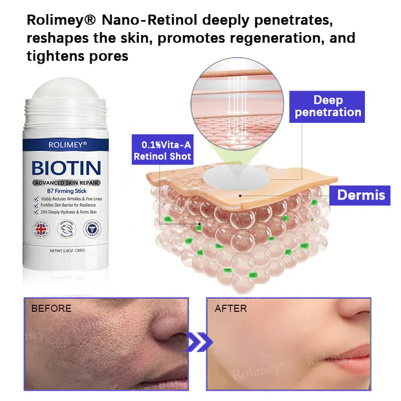🤩Rolimey® Biotin(B7) Firming Stick – Targets Aging, Sagging & Fine Lines | Final Day: Save 50%