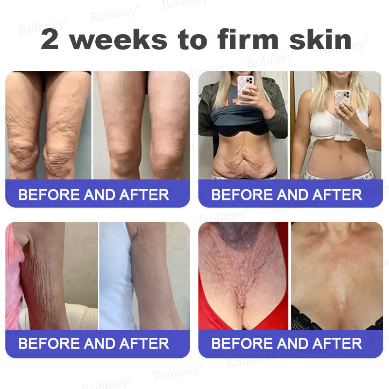 🤩Rolimey® Biotin(B7) Firming Stick – Targets Aging, Sagging & Fine Lines | Final Day: Save 50%