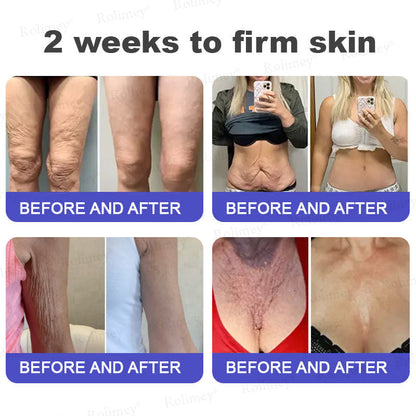 🤩Rolimey® Biotin(B7) Firming Stick – Targets Aging, Sagging & Fine Lines | Final Day: Save 50%