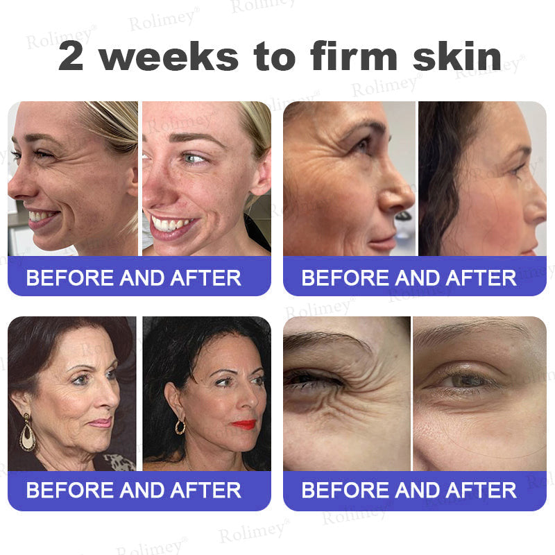 🤩Rolimey® Biotin(B7) Firming Stick – Targets Aging, Sagging & Fine Lines | Final Day: Save 50%
